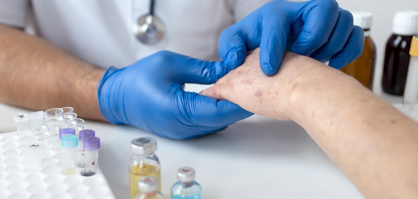 Leishmaniasis treatment