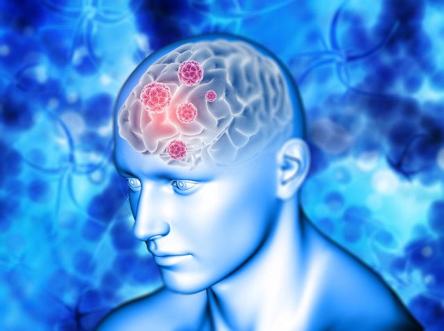 Brain cancer virus Brain cancer virus