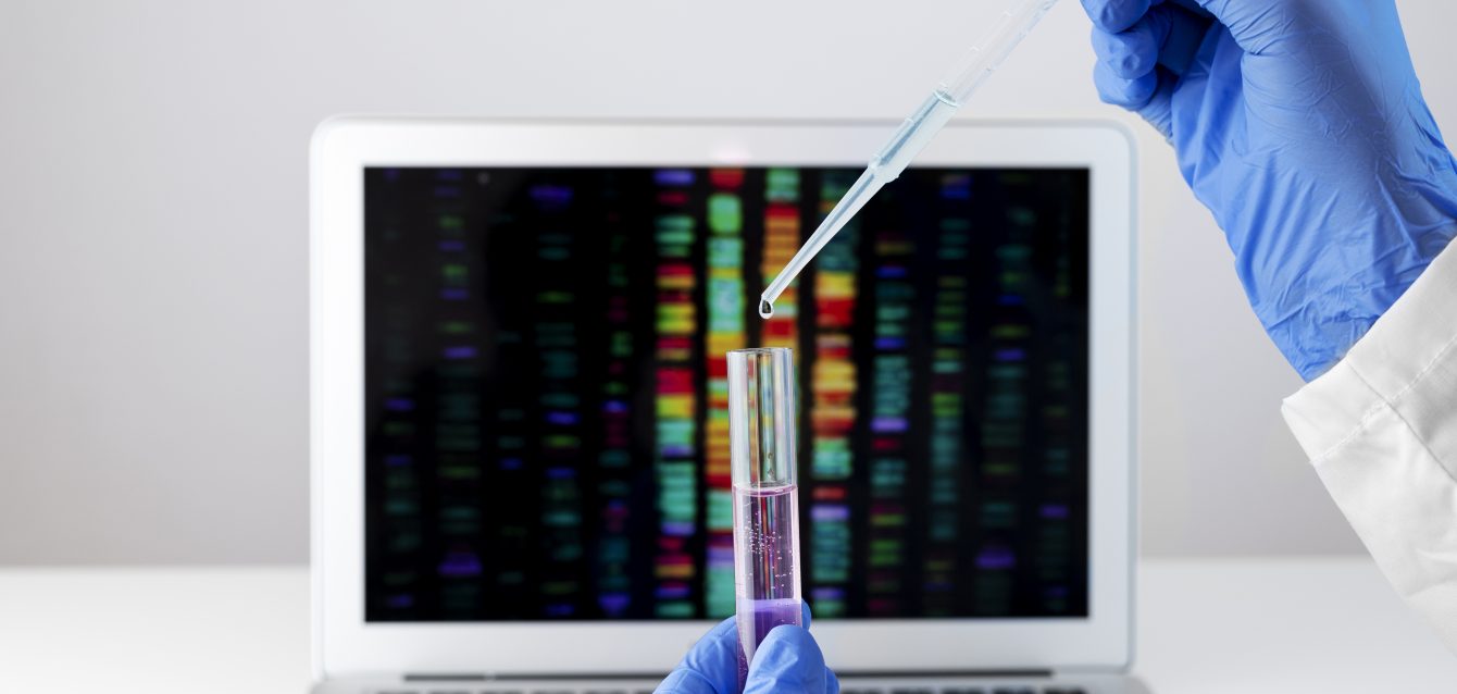 Liquid biopsy Liquid biopsy