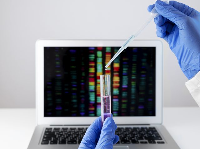 Liquid biopsy Liquid biopsy