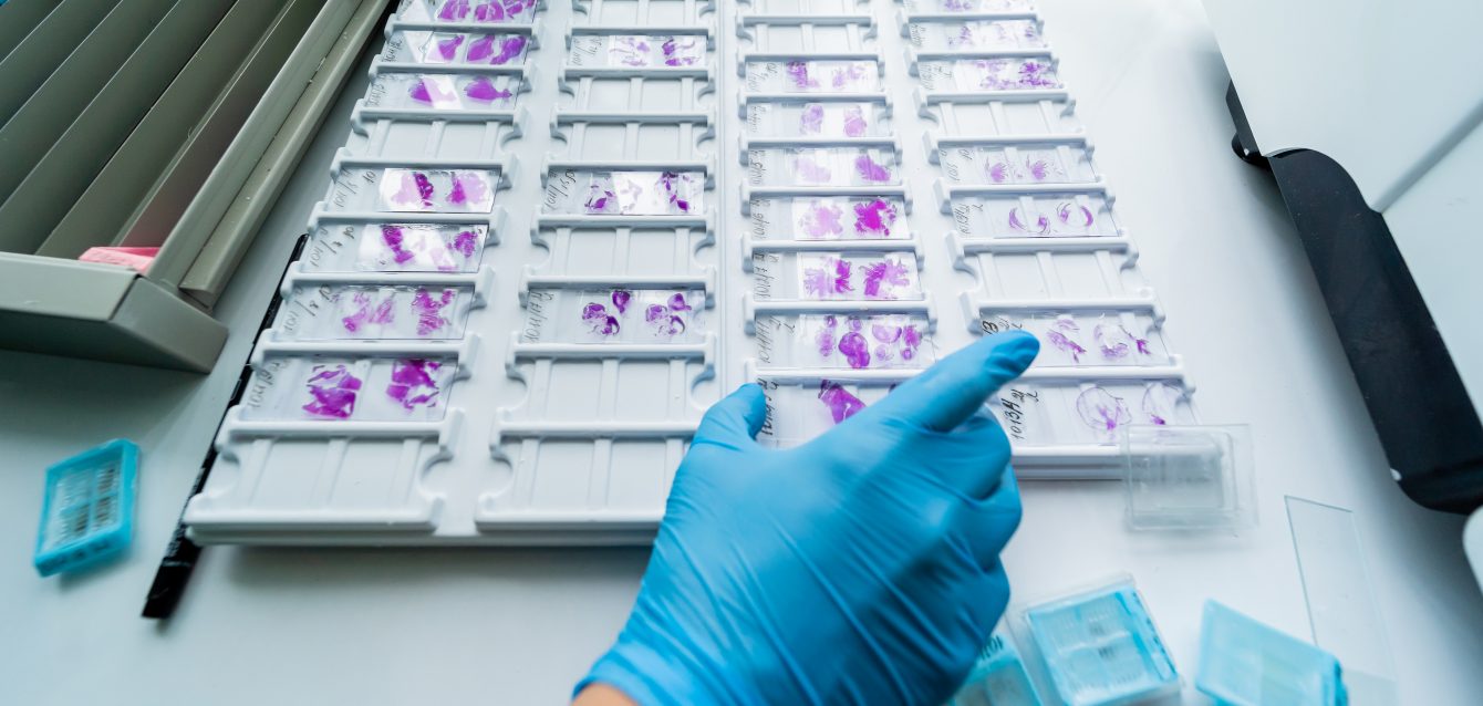 Tumor markers screening