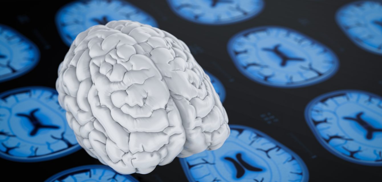 Niveles de azúcar en la sangre