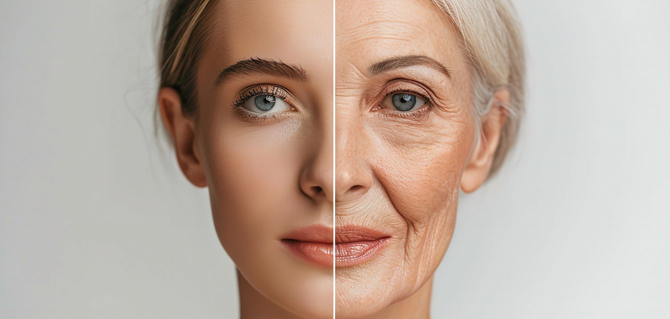 Aging Mitochondrial DNA Aging Mitochondrial DNA