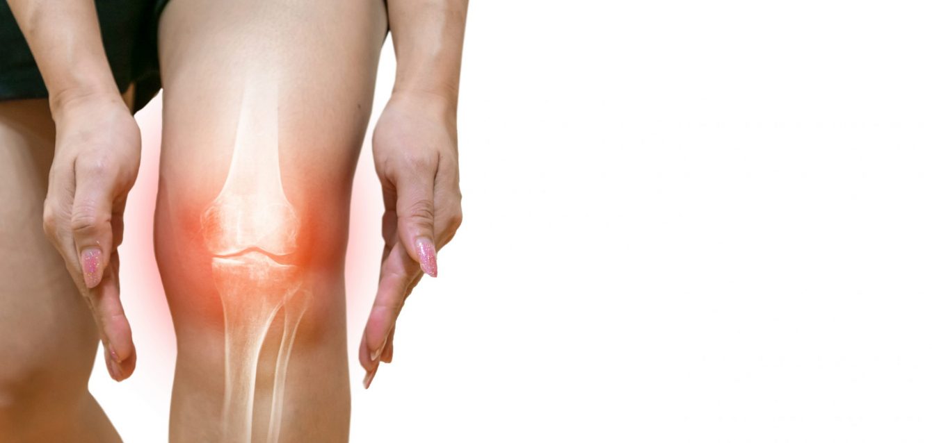 Human leg Osteoarthritis inflammation Of bone joints Human leg Osteoarthritis inflammation Of bone joints
