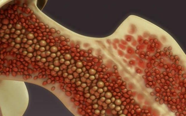 bone marrow_Shutterstock_featured