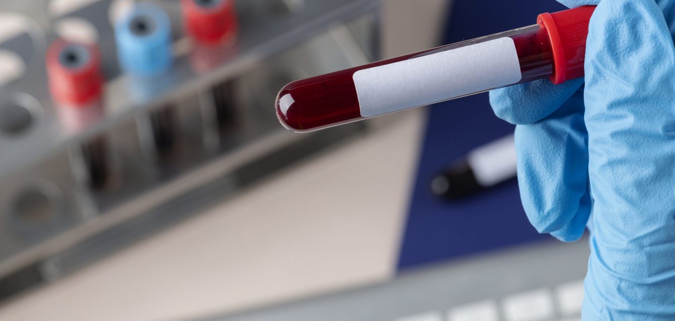 Autism spectrum disorder Autism spectrum disorder