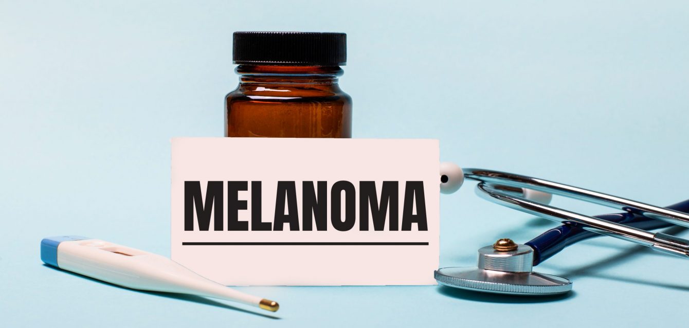 On a blue background - a bottle for pills, a stethoscope, an electronic thermometer and a card with the inscription MELANOMA. Medical concept On a blue background - a bottle for pills, a stethoscope, an electronic thermometer and a card with the inscription MELANOMA. Medical concept