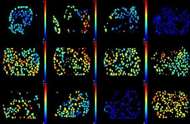Cancer drug delivery