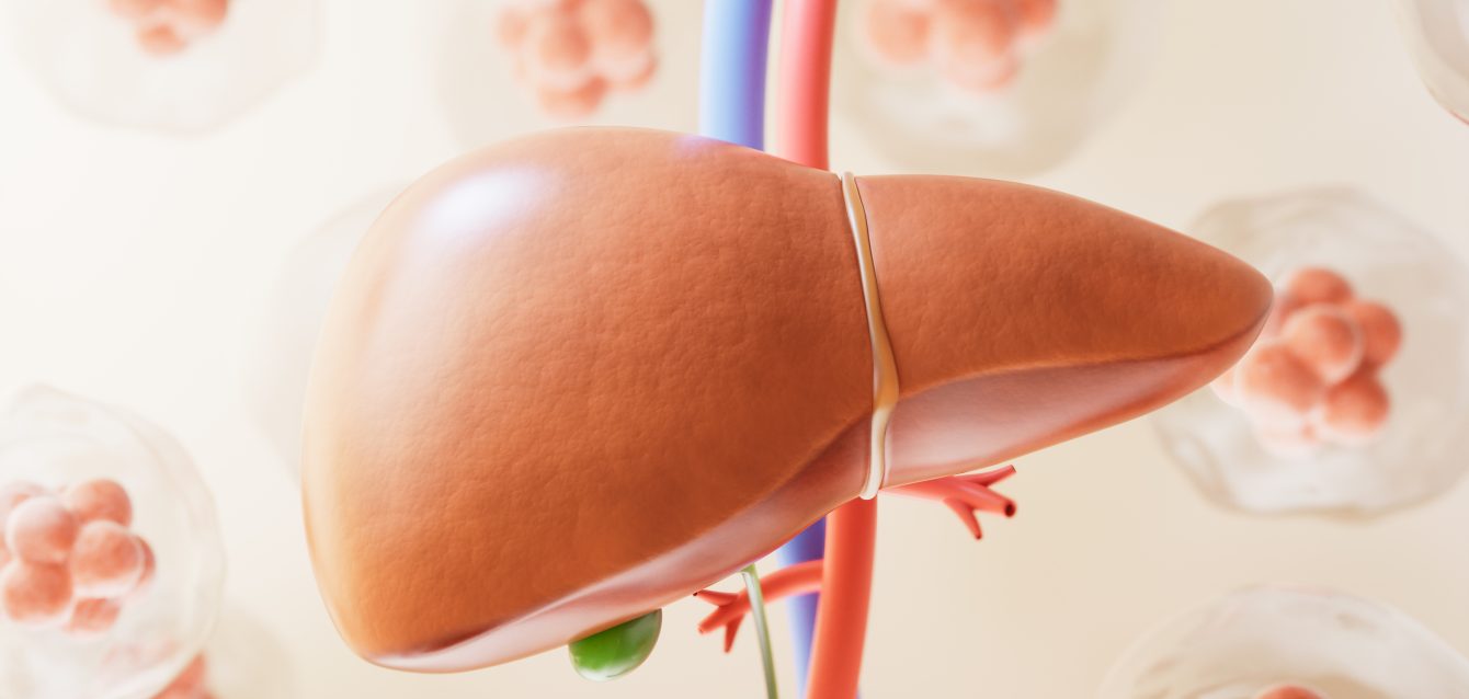 Chronic liver disease Chronic liver disease