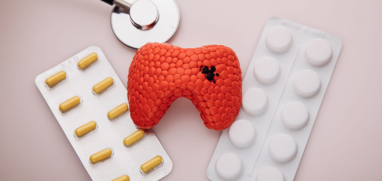 Treatment of diseases of thyroid concept. Model of organ with patalogy and pills. Top view Treatment of diseases of thyroid concept. Model of organ with patalogy and pills. Top view