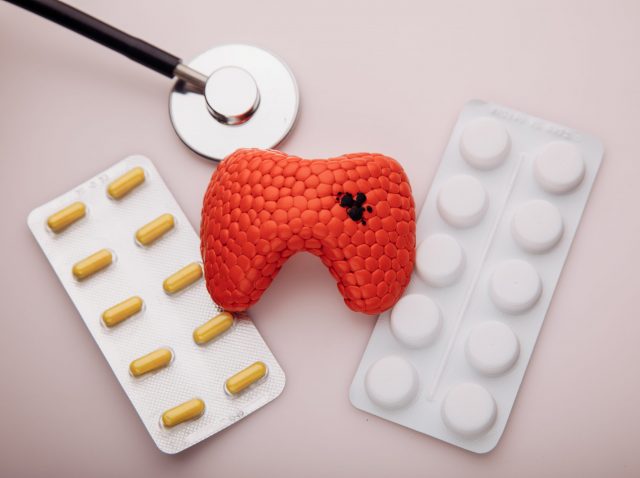 Treatment of diseases of thyroid concept. Model of organ with patalogy and pills. Top view Treatment of diseases of thyroid concept. Model of organ with patalogy and pills. Top view