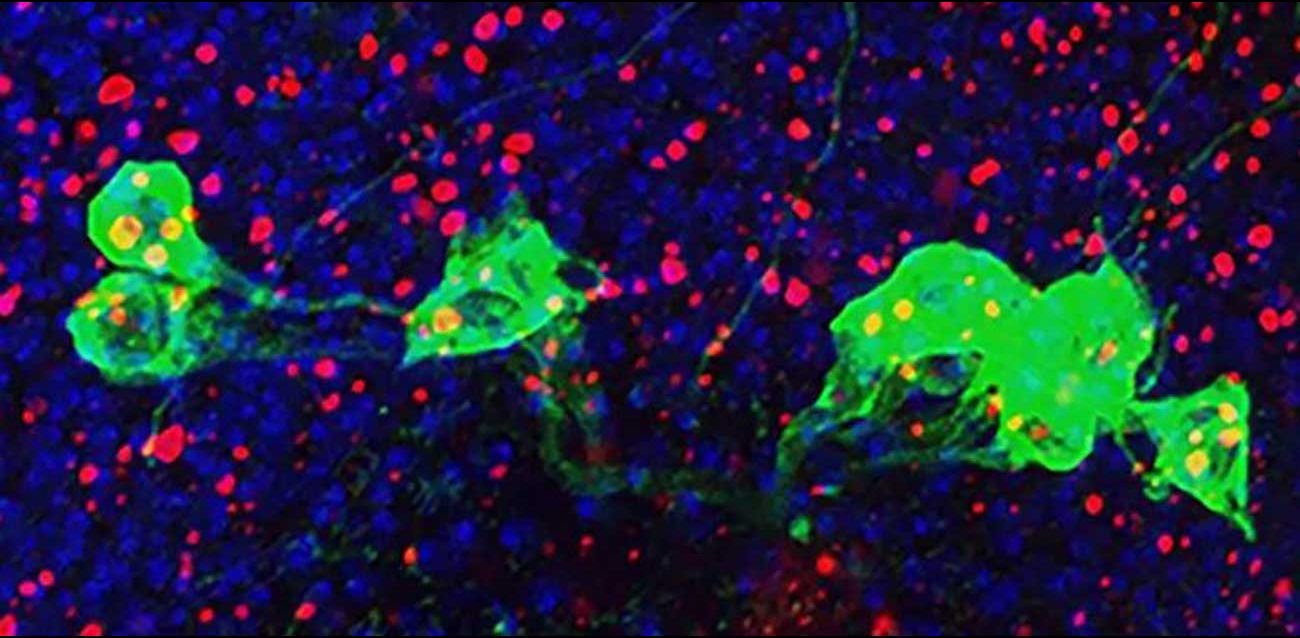 NINDS Giniger Immunity Illustration | Brain Disorders