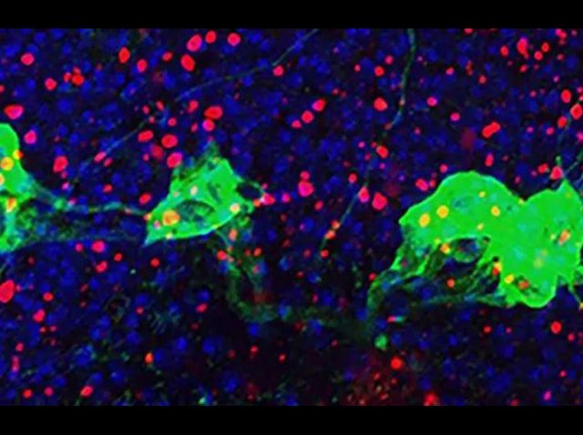 NINDS Giniger Immunity Illustration | Brain Disorders