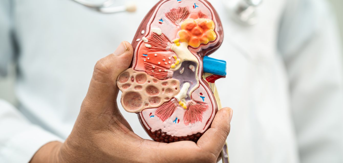 kidney disease (CKD) failed