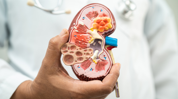 kidney disease (CKD) failed