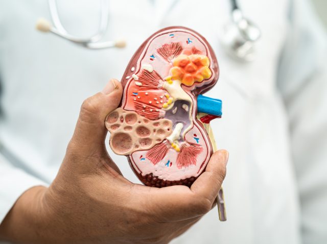 kidney disease (CKD) failed