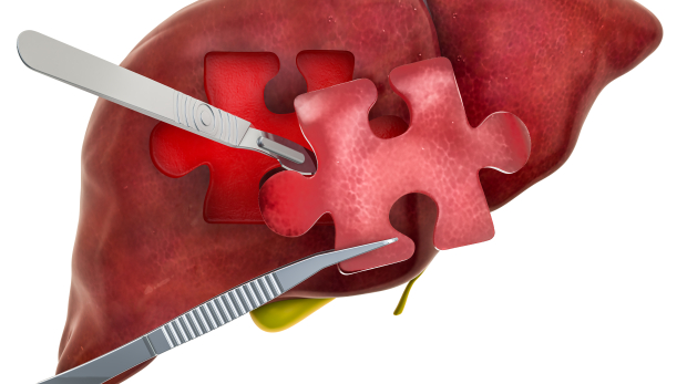 Acute liver failure