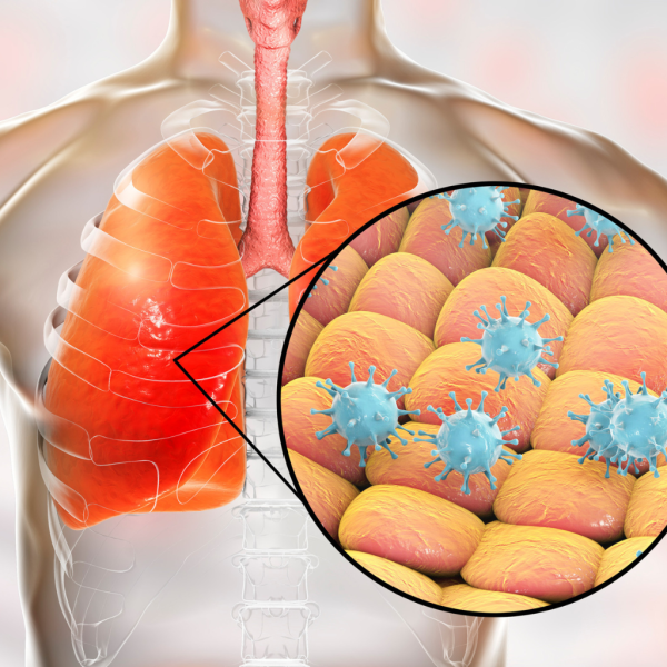 Estudio sobre el virus respiratorio sincitial (VRS)