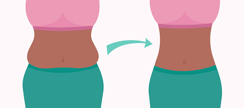 Obesity Illustration Showing Flat and Obese Stomach