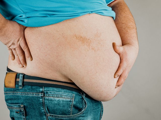 Problemas de salud relacionados con la obesidad Problemas de salud relacionados con la obesidad