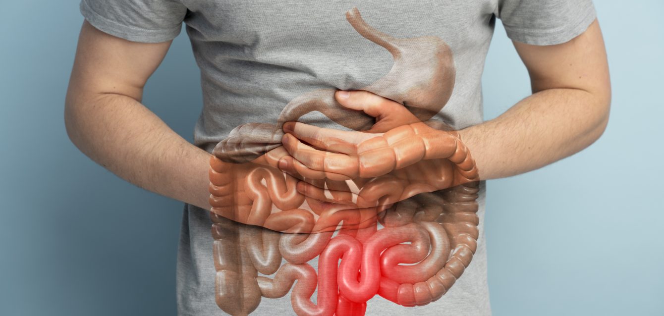 Ensayo clínico sobre la colitis ulcerosa