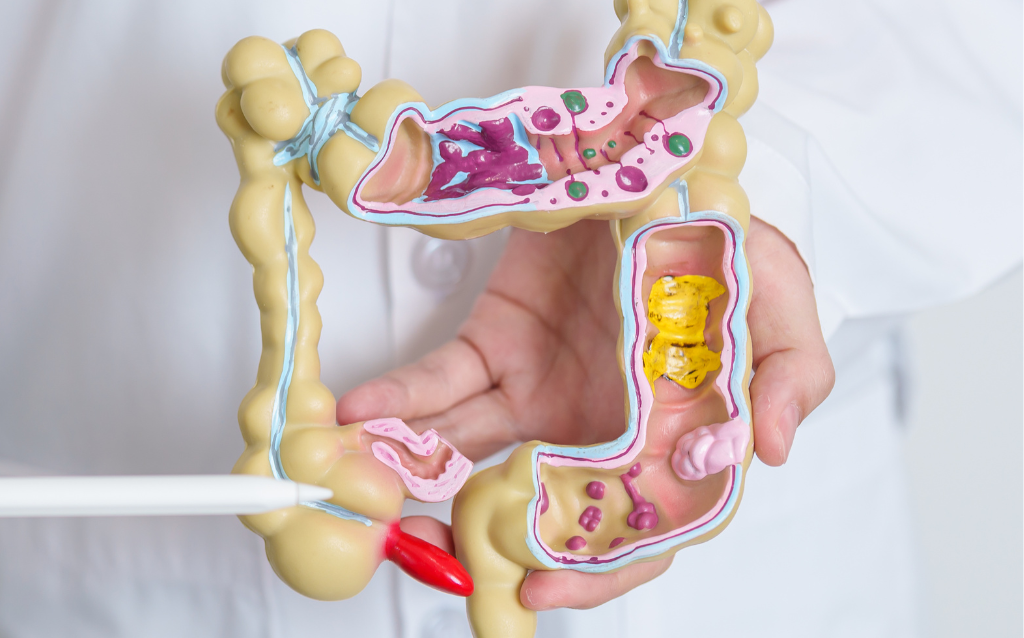 Colorectal cancer treatment