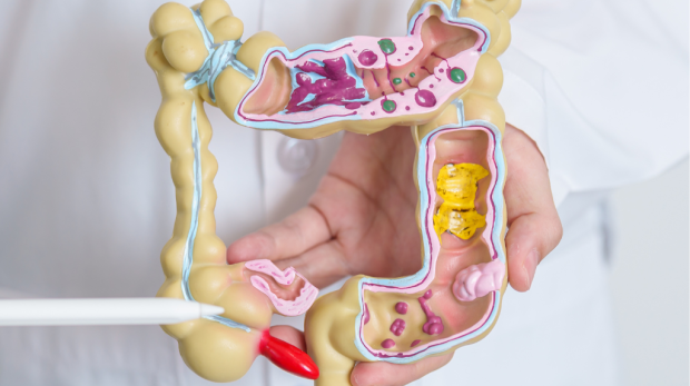 Tratamiento del cáncer colorrectal