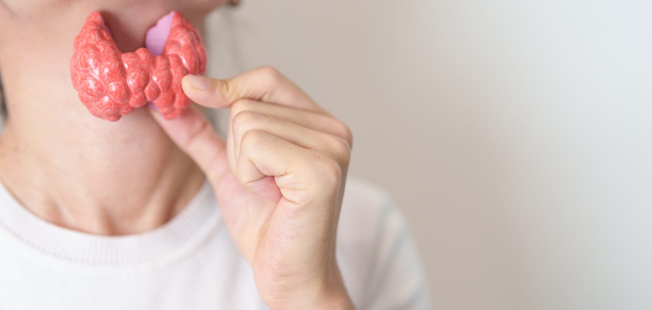 Mujer sosteniendo un modelo anatómico de tiroides humana con su cuello. Hipertrofia.