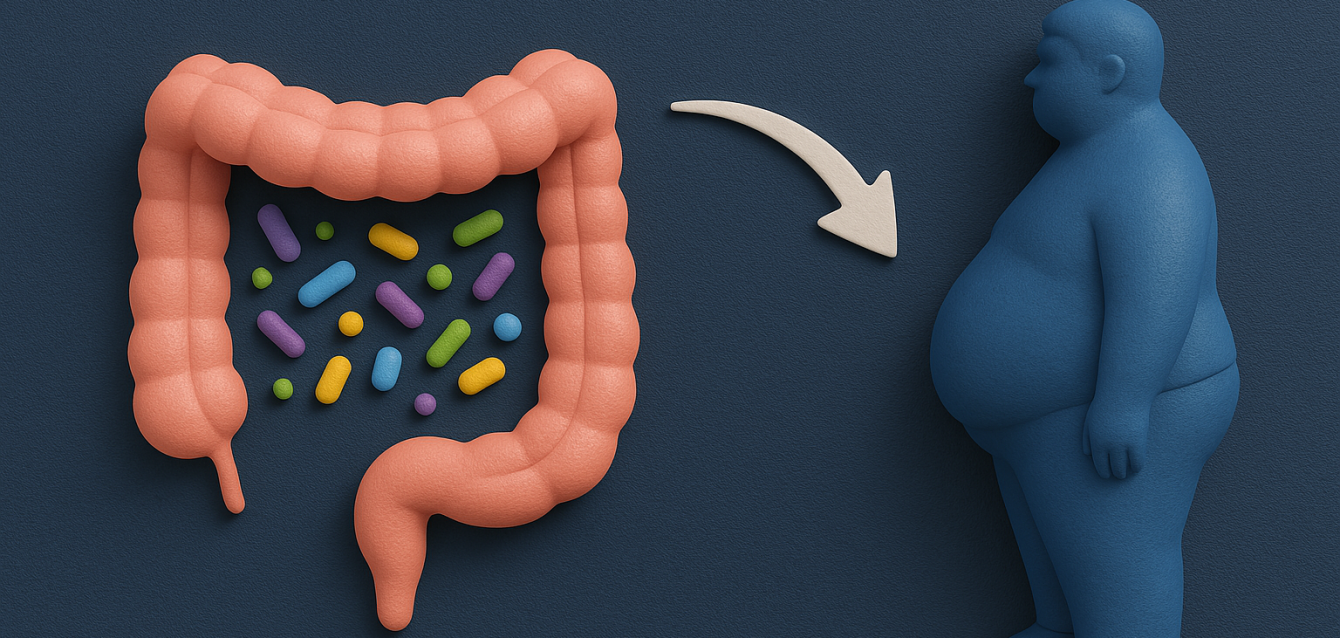 Infografía que muestra cómo la microbiota intestinal afecta a la obesidad.