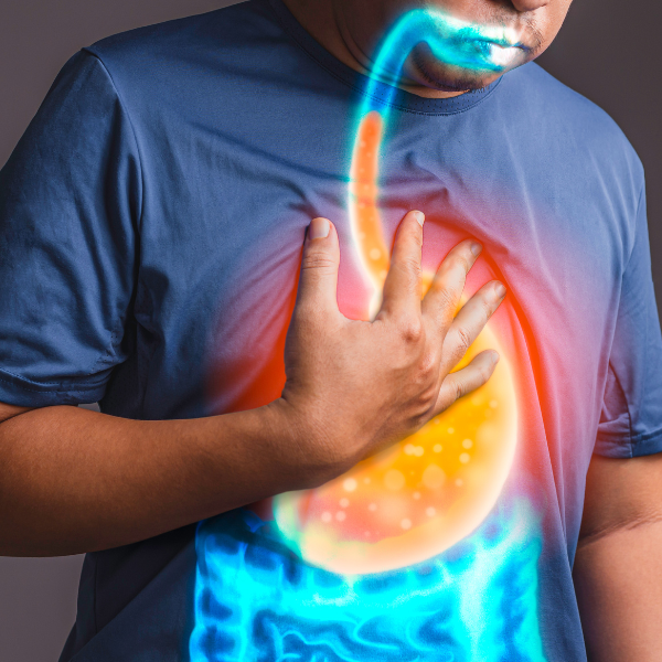 Active-Studies-12 Erosive Esophagitis