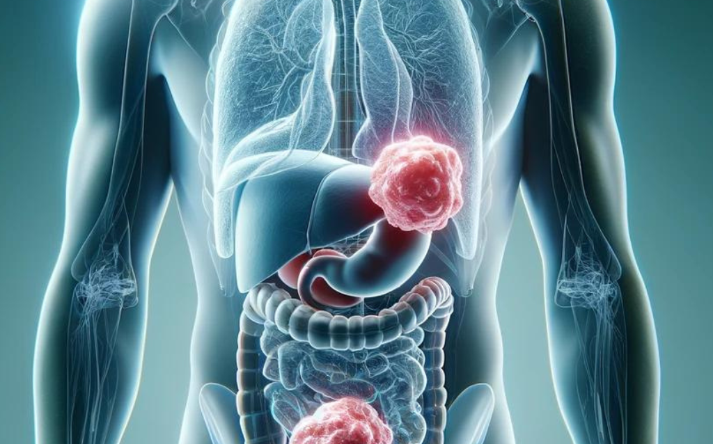 Images-Stock-2024-04-18T171351.853 Solid Tumor