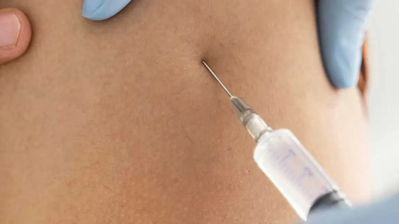 Foto del estómago en el que se inyecta la vacuna a un paciente de un ensayo sobre el ébola