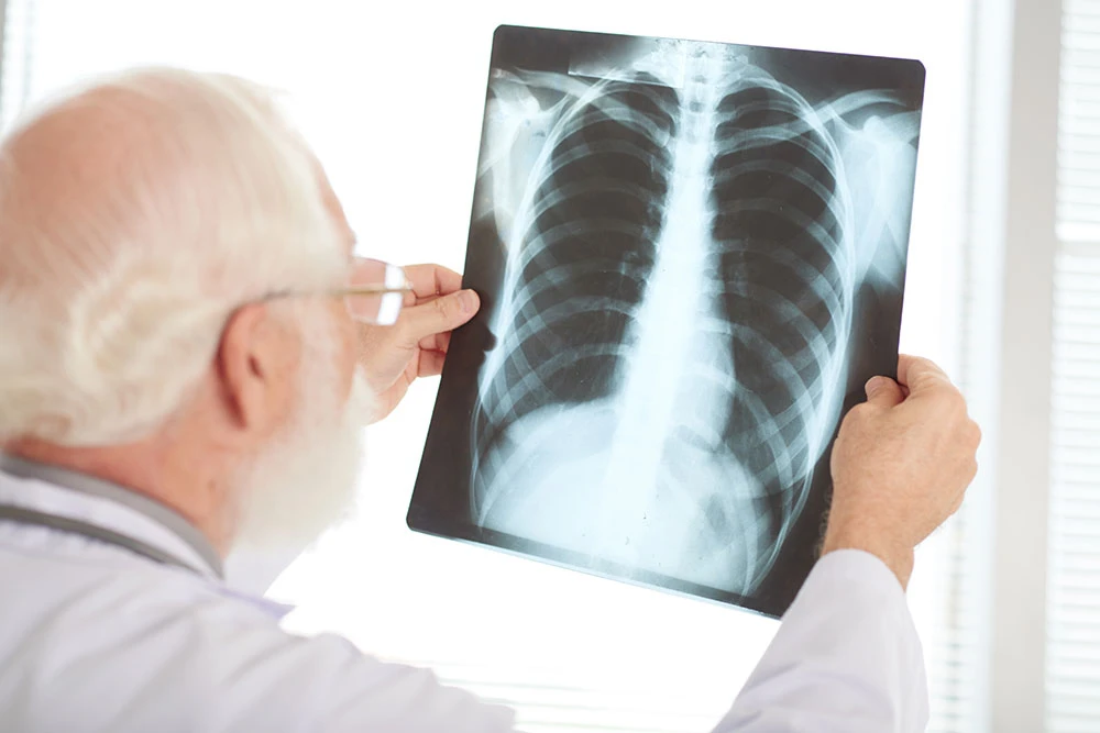 El médico comprueba si hay cáncer de pulmón en las radiografías