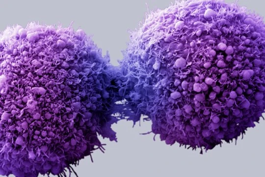 células cancerosas Propagación