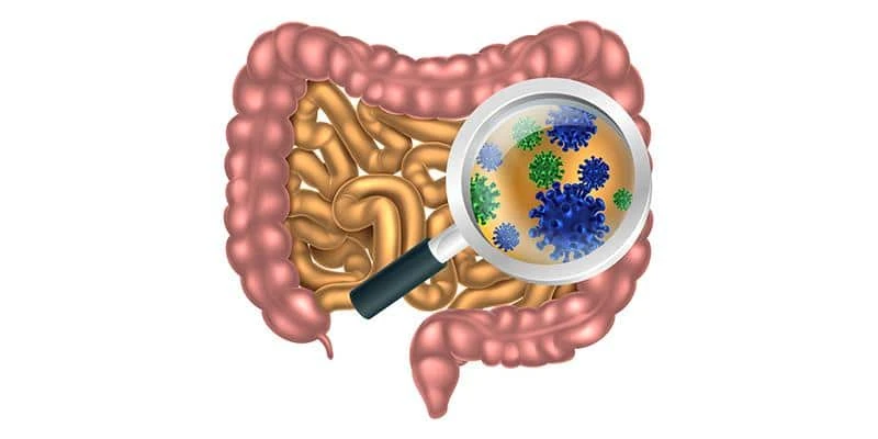 Bacterias intestinales Artritis reumatoide