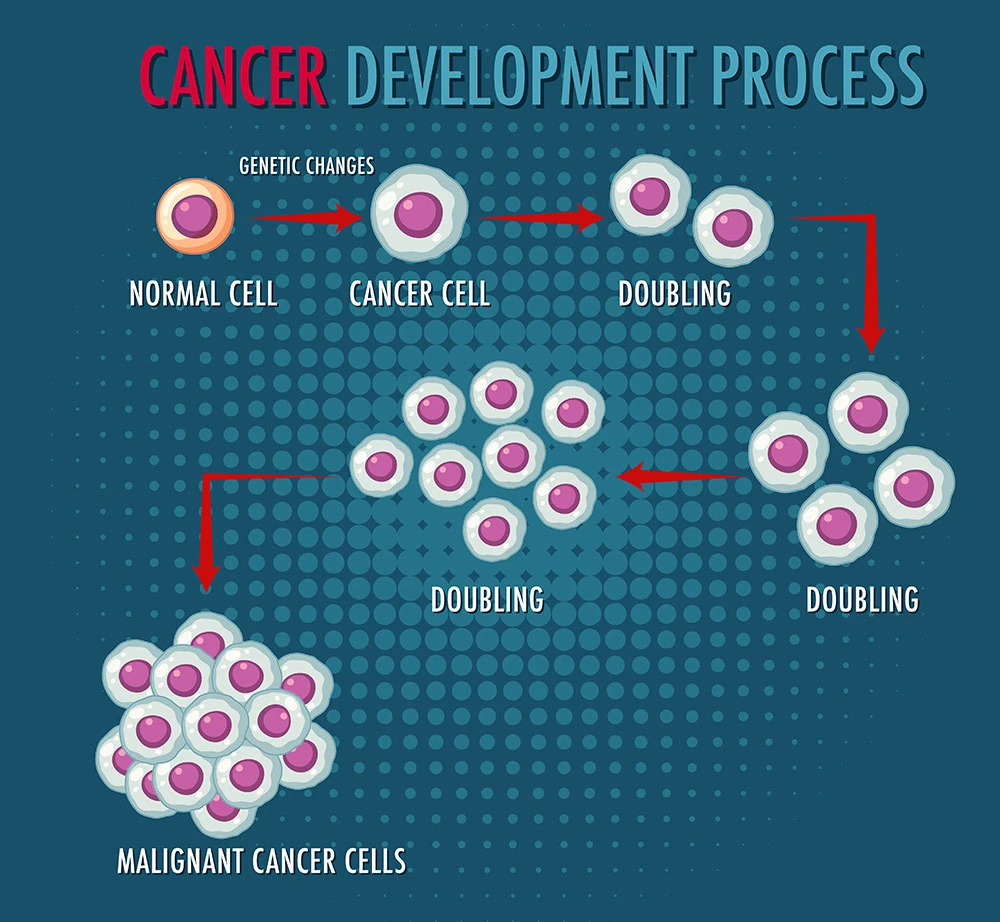 Ilustración del proceso de desarrollo del cáncer