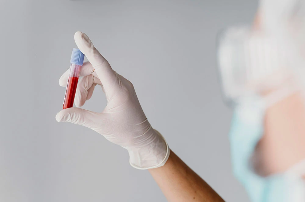 Diseño de un análisis de sangre Mujer en laboratorio con frasco de sangre